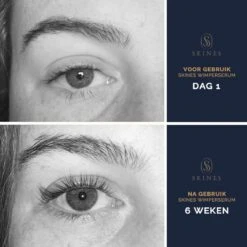 Skines® Wimperserum Premium – Eyelash Serum - Wenkbrauw Serum - Wimper Groei - 3ML 16 Skines® Wimperserum Premium – Eyelash Serum - Wenkbrauw Serum - Wimper Groei - 3ML -Maybelline Winkel 1200x1200 753