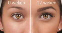 100% Natuurlijke Groei - Wenkbrauwserum - Vollere Wenkbrauwen - Castor Olie - Wenkbrauw Serum - 10ML -Maybelline Winkel 1200x645