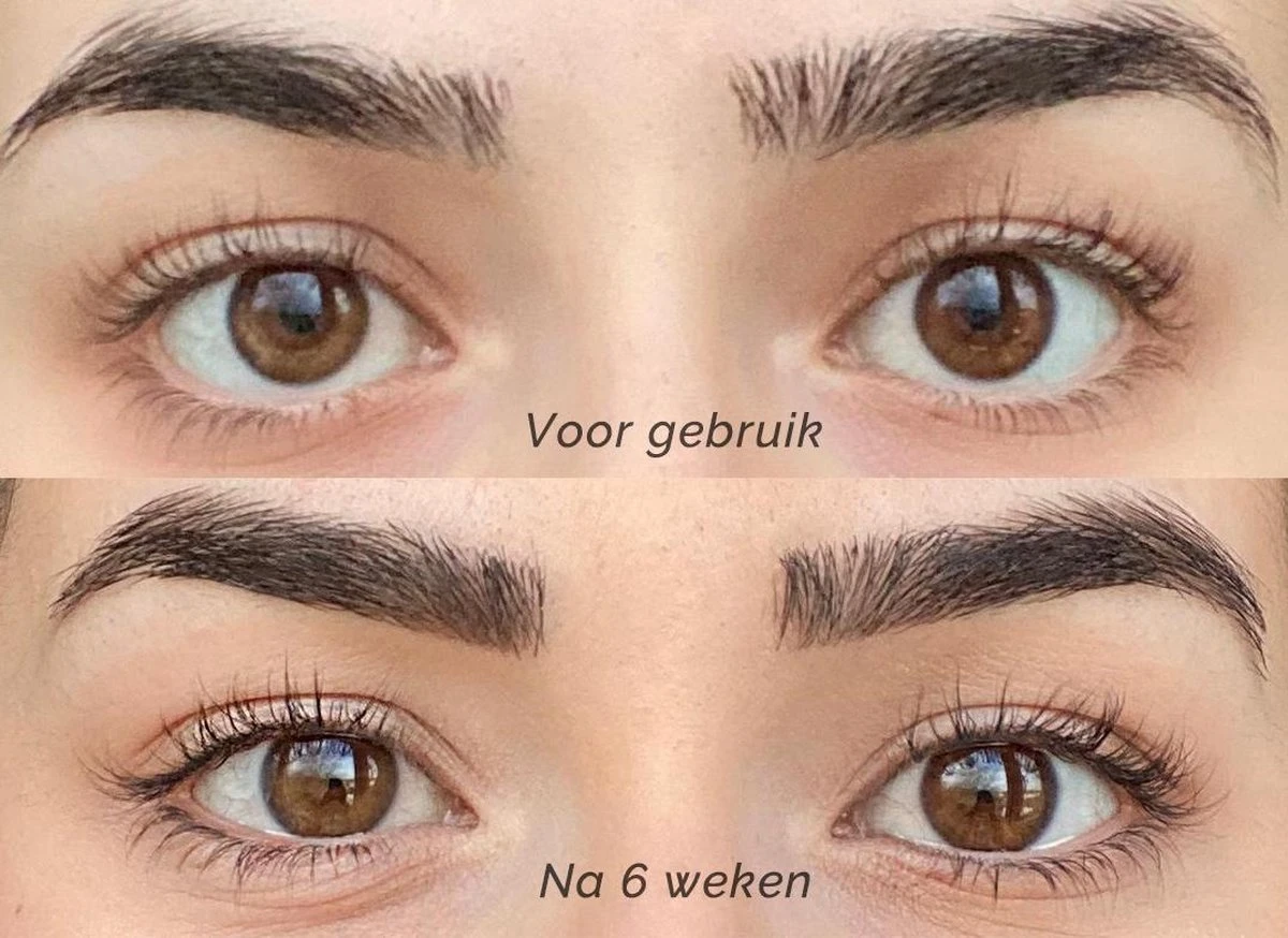 Skines® Wimperserum Premium – Eyelash Serum - Wenkbrauw Serum - Wimper Groei - 3ML 10 Skines® Wimperserum Premium – Eyelash Serum - Wenkbrauw Serum - Wimper Groei - 3ML - Afbeelding 8